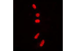 Immunofluorescent analysis of p53 (AcK381) staining in HeLa cells. (p53 anticorps  (acLys381, C-Term))