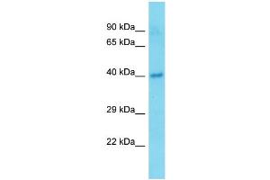 Host:  Rabbit  Target Name:  Tmem25  Sample Type:  Mouse Pancreas lysates  Antibody Dilution:  1. (TMEM25 anticorps  (C-Term))