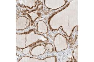 Immunohistochemical staining of human thyroid gland with PARP10 polyclonal antibody  shows distinct cytoplasmic positivity in glandular cells at 1:20-1:50 dilution.