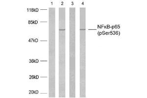 Western blot analysis using NF-κB p65 (phospho-Ser536) antibody (E011014). (NF-kB p65 anticorps  (pSer536))