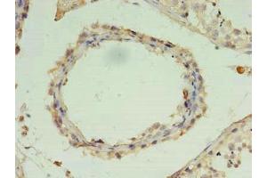 Immunohistochemistry of paraffin-embedded human testis tissue using ABIN7176283 at dilution of 1:100 (ZNF397 anticorps  (AA 1-275))