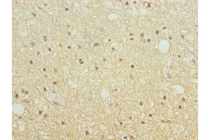 Immunohistochemistry of paraffin-embedded human brain tissue using ABIN7151639 at dilution of 1:100 (SH3G2 anticorps  (AA 1-270))