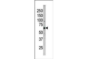 Image no. 1 for anti-Cell Division Cycle 25 Homolog B (S. Pombe) (CDC25B) (pSer187) antibody (ABIN358100) (CDC25B anticorps  (pSer187))
