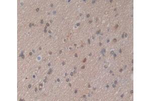 Used in DAB staining on fromalin fixed paraffin- embedded brain tissue