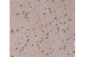 Used in DAB staining on fromalin fixed paraffin- embedded brain tissue (PSMG2 anticorps  (AA 1-264))