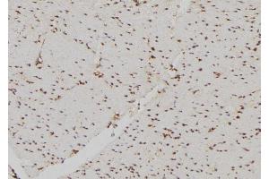 ABIN6269226 at 1/100 staining Human gastric tissue by IHC-P. (DDIT3 anticorps  (N-Term))