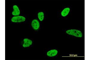 Immunofluorescence of monoclonal antibody to BAX on HeLa cell. (BAX anticorps  (AA 1-192))