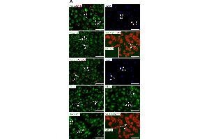 Expression pattern of Notch ligands and receptors in first trimester decidual tissue. (Vimentin anticorps)