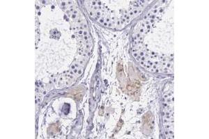 Immunohistochemical staining of human testis with THSD7A polyclonal antibody  shows moderate membranous positivity in subsets of Leydig cells. (THSD7A anticorps)