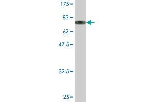 Western Blot detection against Immunogen (83. (YARS anticorps  (AA 1-528))