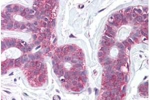 Anti-SLC39A6 antibody  ABIN960811 IHC staining of human breast. (SLC39A6 anticorps  (Internal Region))
