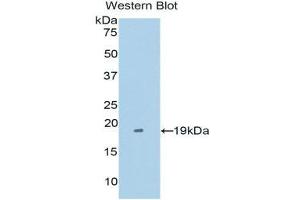 Western Blotting (WB) image for anti-Tumor Necrosis Factor Receptor Superfamily, Member 21 (TNFRSF21) (AA 420-568) antibody (ABIN1176213) (TNFRSF21 anticorps  (AA 420-568))