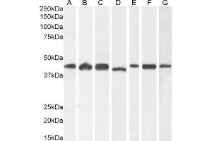 (ABIN185219) (1 μg/mL) staining of A431 (A) and HeLa (B), (2 μg/mL) HEK293 (C) and (0.