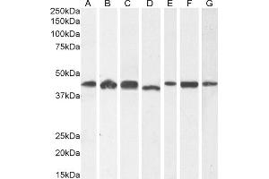 (ABIN185219) (1 μg/mL) staining of A431 (A) and HeLa (B), (2 μg/mL) HEK293 (C) and (0. (ACTR1A anticorps  (C-Term))