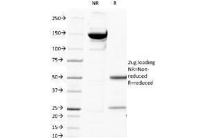 Purified Beta-2-Microglobulin Mouse Monoclonal Antibody (B2M/1118).