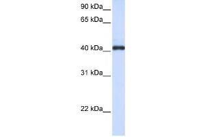 Western Blotting (WB) image for anti-Fc Receptor-Like A (FCRLA) antibody (ABIN2459358) (FCRLA anticorps)