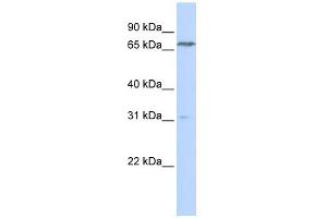PCCA antibody used at 1 ug/ml to detect target protein. (PCCA anticorps  (N-Term))