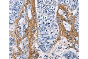 Immunohistochemistry (IHC) image for anti-Collagen, Type III, alpha 1 (COL3A1) antibody (ABIN2427981) (COL3A1 anticorps)