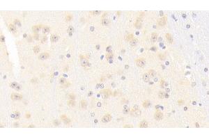 Detection of NOS1 in Mouse Cerebrum Tissue using Polyclonal Antibody to Nitric Oxide Synthase 1, Neuronal (NOS1)