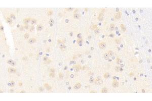 Detection of NOS1 in Mouse Cerebrum Tissue using Polyclonal Antibody to Nitric Oxide Synthase 1, Neuronal (NOS1) (NOS1 anticorps  (AA 691-826))