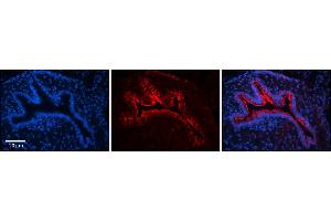 Rabbit Anti-CKAP4 Antibody     Formalin Fixed Paraffin Embedded Tissue: Human Bronchial Epithelial Tissue  Observed Staining: Membrane and cytoplasmic in excellent staining !
