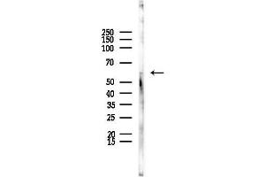 Western blot analysis of lysates from EC304 cells, using CHRM5 Antibody at 1/1000 dilution.