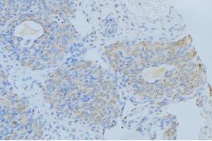 ABIN6276366 at 1/100 staining Human uterus tissue by IHC-P. (IL-2 anticorps  (Internal Region))