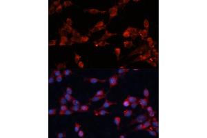 Immunofluorescence analysis of NIH-3T3 cells using eIF3B Polyclonal Antibody (ABIN6130364, ABIN6140053, ABIN6140054 and ABIN6214441) at dilution of 1:100 (40x lens). (EIF3B anticorps  (AA 100-350))