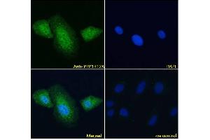 ABIN6391349 Immunofluorescence analysis of paraformaldehyde fixed U2OS cells, permeabilized with 0. (PPP1R12A anticorps  (C-Term))