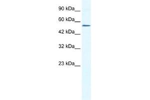 WB Suggested Anti-ZNF286 Antibody Titration:  0. (ZNF286A anticorps  (N-Term))