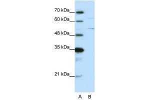 Western Blot showing HNRPK antibody used at a concentration of 1-2 ug/ml to detect its target protein.