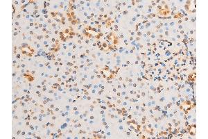 ABIN6267301 at 1/100 staining rat kidney tissue sections by IHC-P.
