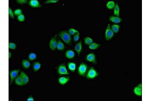 Immunofluorescent analysis of PC-3 cells using ABIN7155150 at dilution of 1:100 and Alexa Fluor 488-congugated AffiniPure Goat Anti-Rabbit IgG(H+L) (Hexokinase 2 anticorps  (AA 334-526))
