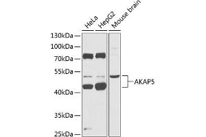 Western blot analysis of extracts of various cell lines, using  Antibody (ABIN6129178, ABIN6136707, ABIN6136709 and ABIN6218330) at 1:1000 dilution. (AKAP5 anticorps  (AA 1-270))
