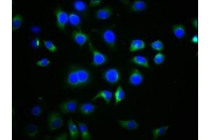 Immunofluorescence staining of A549 cells with ABIN7168752 at 1:77, counter-stained with DAPI. (DVL2 anticorps  (AA 1-240))