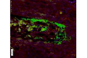 Formalin-fixed and paraffin embedded human laryngeal cancer tissue labeled with Anti-APOH Polyclonal Antibody, Unconjugated  at 1:200 followed by conjugation to the secondary antibody, Goat Anti-Rabbit IgG, AF488 conjugated -AF488), and DAPI staining