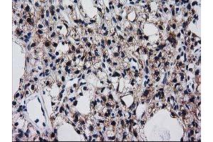 Immunohistochemistry (IHC) image for anti-Bridging Integrator 3 (BIN3) antibody (ABIN1496923)