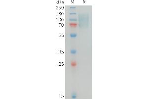 Human MERTK Protein, His Tag on SDS-PAGE under reducing condition.