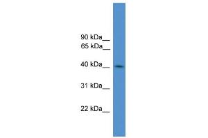 WB Suggested Anti-KLHDC3 Antibody Titration: 0.