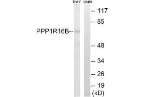 Western blot analysis of extracts from mouse brain cells, using PPP1R16B antibody. (PPP1R16B anticorps  (Internal Region))