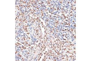 Immunohistochemistry of paraffin-embedded human appendix using Cathepsin G antibody (ABIN6127686, ABIN6139228, ABIN6139230 and ABIN6217069) at dilution of 1:100 (40x lens).