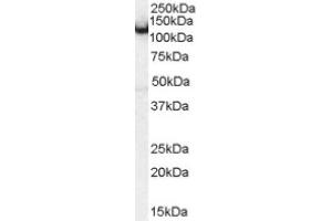 Image no. 1 for anti-Amphiphysin (AMPH) (Internal Region) antibody (ABIN374682) (Amphiphysin anticorps  (Internal Region))