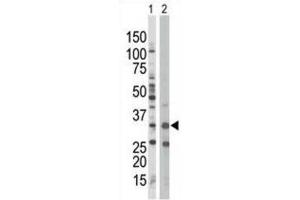 Western Blotting (WB) image for anti-Protein Kinase, AMP-Activated, beta 1 Non-Catalytic Subunit (PRKAB1) antibody (ABIN3002958)