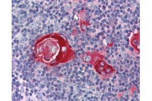 Immunohistochemistry (IHC) image for anti-Zinc Finger Protein 36, C3H Type, Homolog (Mouse) (ZFP36) (N-Term) antibody (ABIN2775765)