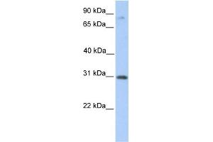 WB Suggested Anti-ABHD13 Antibody Titration:  0. (ABHD13 anticorps  (C-Term))