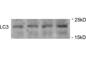 Immunoblots of SH-SY5Y cells treated with MPP+ for 24h was probed with AP32191PU-N.