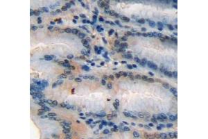 Used in DAB staining on fromalin fixed paraffin-embedded stomach tissue