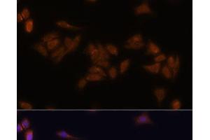 Immunofluorescence analysis of U-2 OS cells using RPS17 Polyclonal Antibody at dilution of 1:100.