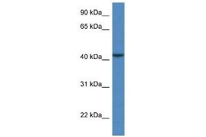 Western Blot showing CAB39L antibody used at a concentration of 1 ug/ml against COLO205 Cell Lysate (CAB39L anticorps  (N-Term))