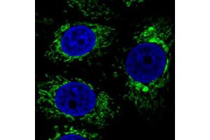 Immunofluorescent staining of MCF7 cells with CS monoclonal antibody, clone CL2545  (Green) shows specific mitochondrial. (CS anticorps)